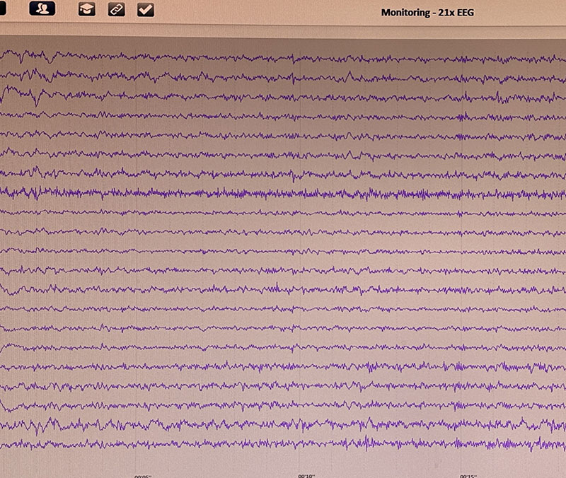 Neuropsychologische Praxis Dr Vohn